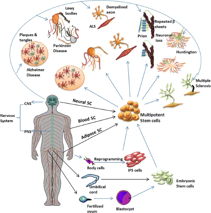 Ein Diagramm, das die potenziellen Erkrankungen veranschaulicht, die Stammzelltherapien im Bereich der Neurologie behandeln könnten.