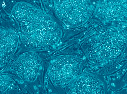 Wie Sie den Nutzen Ihrer Stammzelltherapie maximieren können
