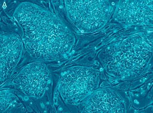 Pluripotente Stammzellen für die regenerative Medizin