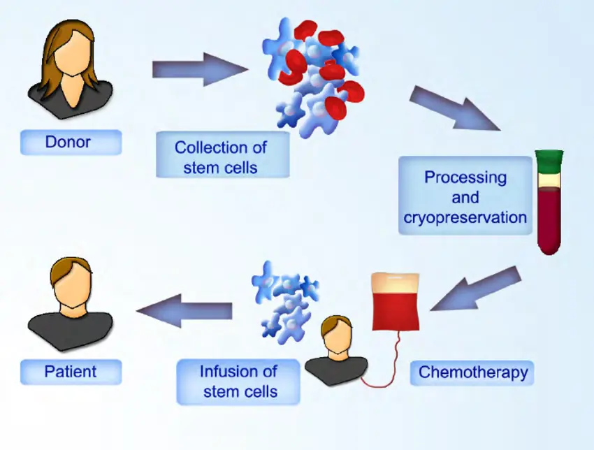 Stammzelltransplantation