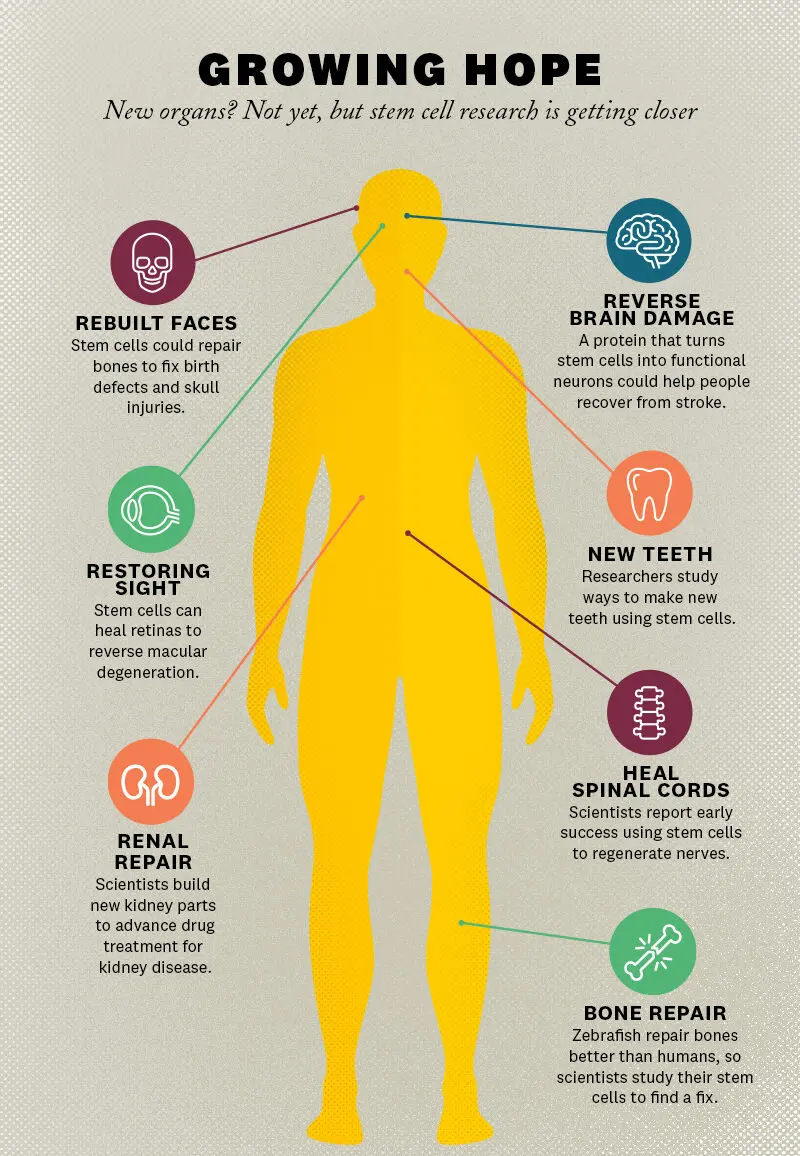 Eine Infografik, die veranschaulicht, wie Stammzellen in Anti-Aging-Therapien eingesetzt werden können